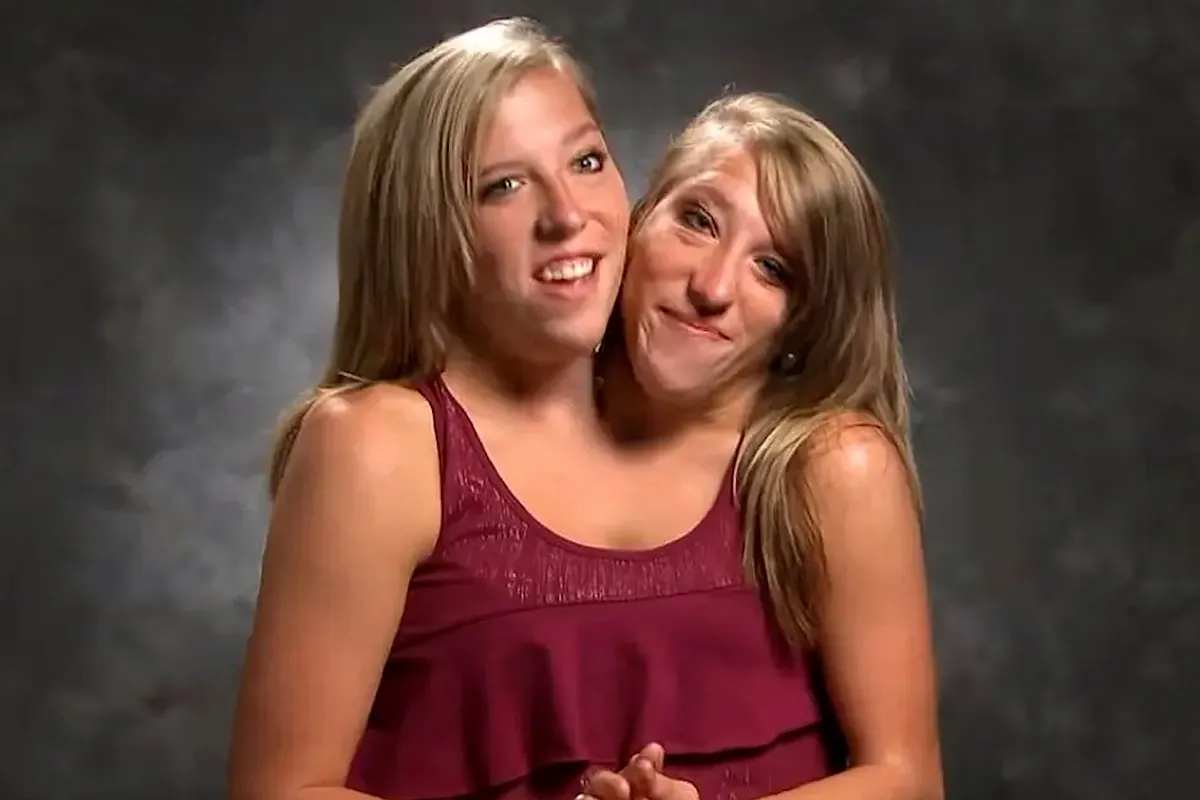 Abby et Brittany adolescentes