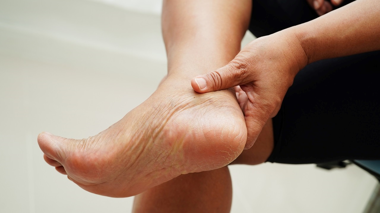 Pieds rouges avec marques anormales