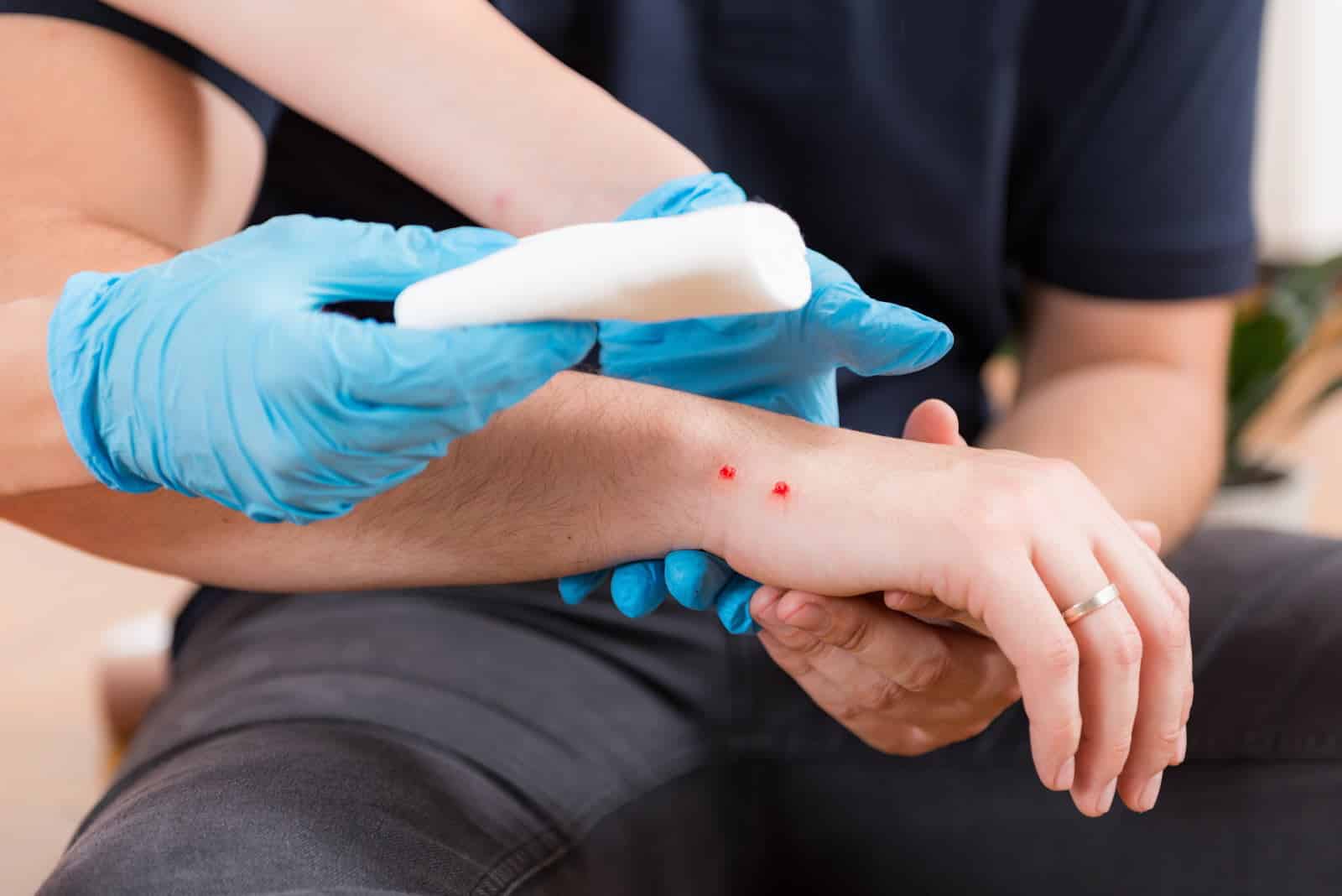 Prise en charge médicale d'une morsure