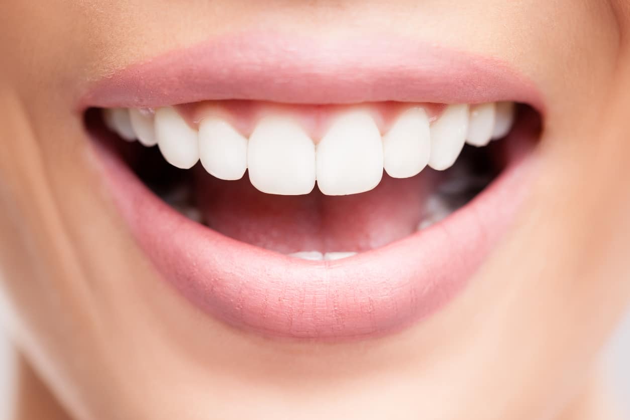 Dents blanches et éclatantes