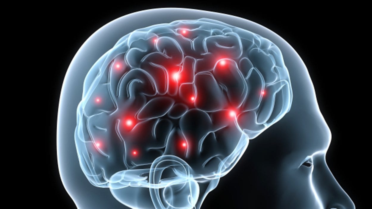 Cerveau en activité lors d'un défi visuel