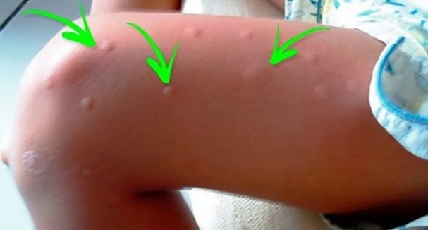 Plantes répulsives contre les moustiques