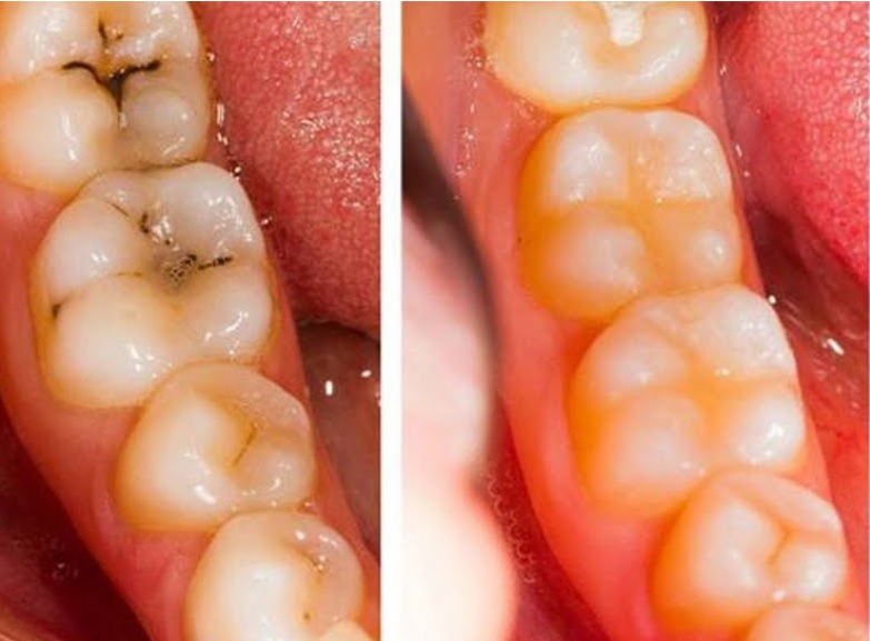 Représentation visuelle des soins naturels pour les dents