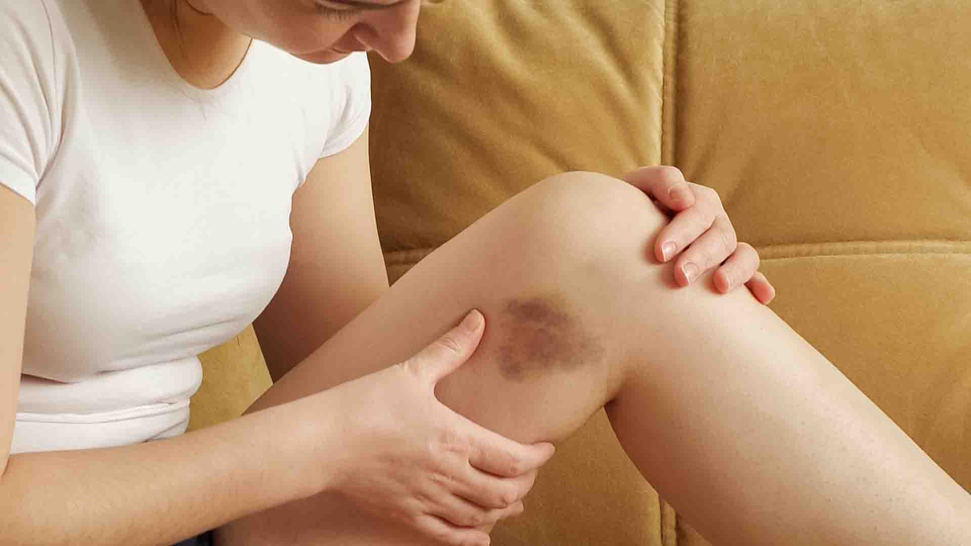 mains présentant une coloration bleutée