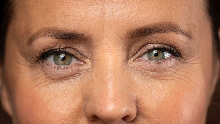 Visage féminin mettant en lumière les rides d'expression