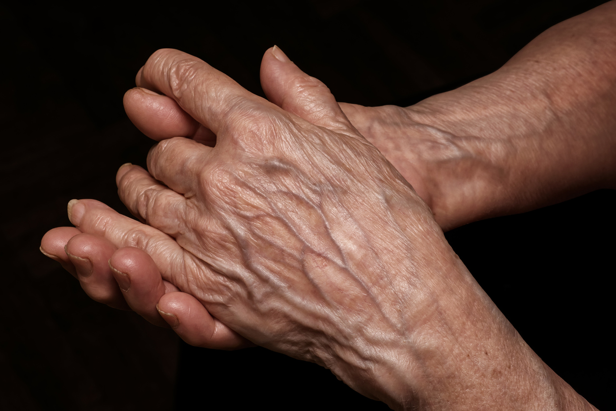 Détail de veines visibles sur une main