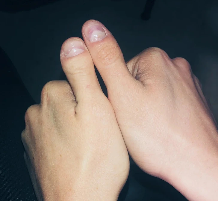 Deux pouces de forme différente