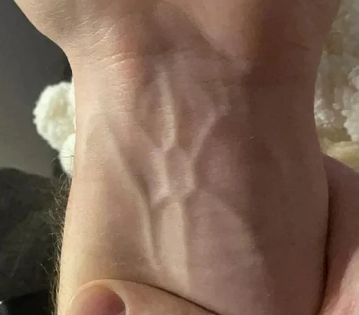 Motif veineux hexagonal sur un poignet