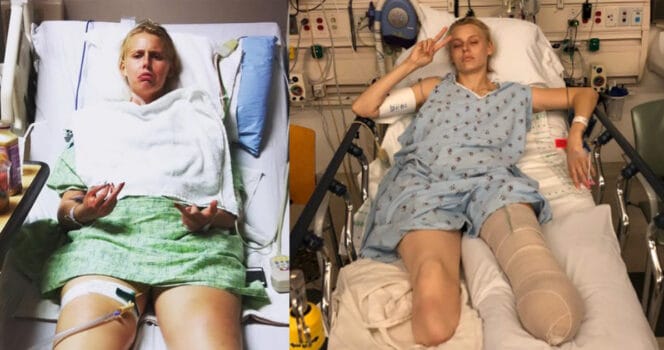 Lauren Wasser avant son amputation