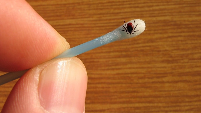 Matériel de prélèvement et de précaution à utiliser en cas de suspicion