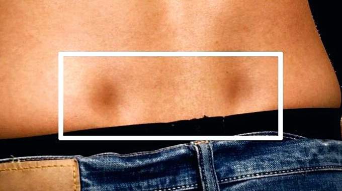 Illustration montrant la position des fossettes et leur relation avec l'anatomie